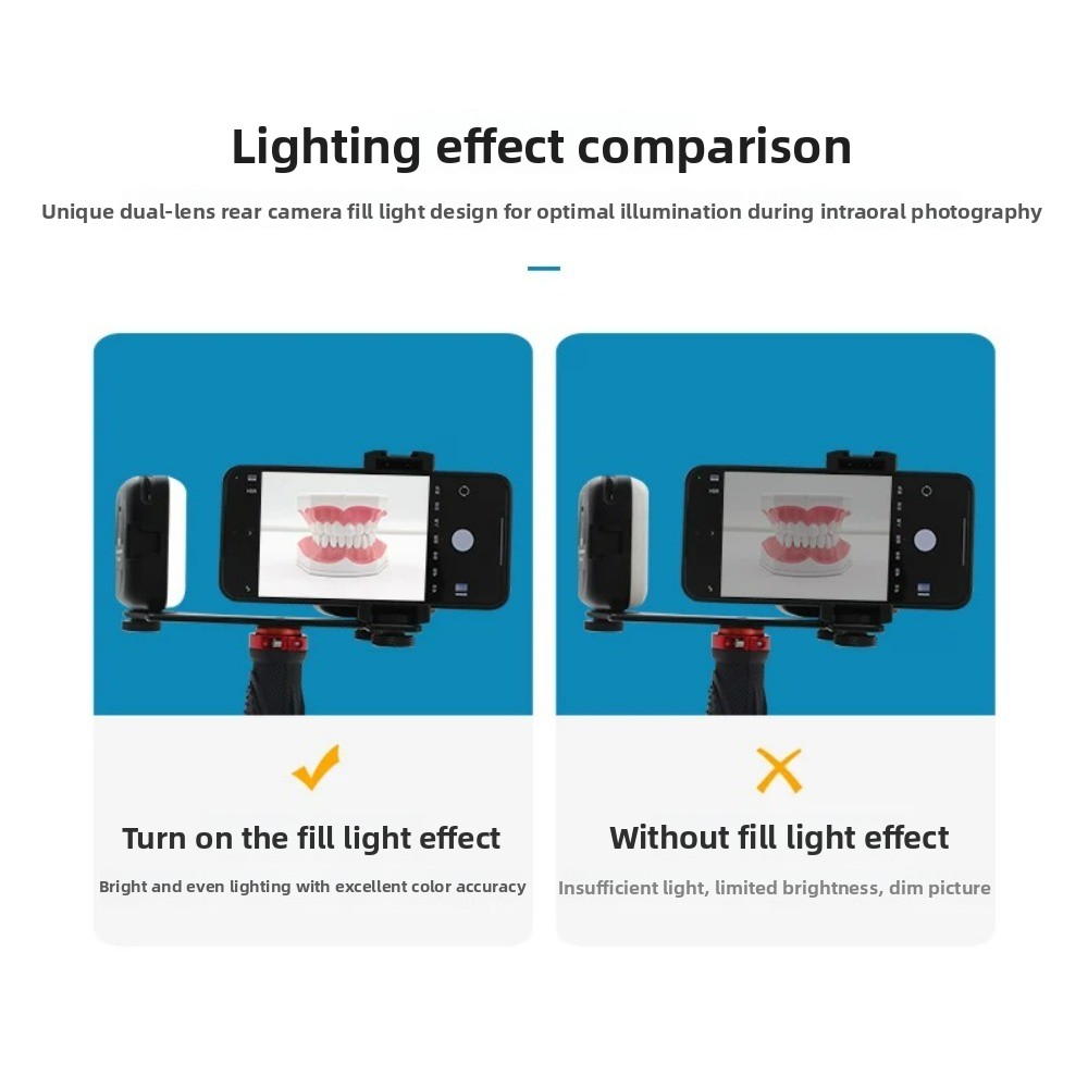 치과 사진 촬영 조명, 스마트폰용 블루투스 LED 플래 - Photography Led Lighting Kit 리뷰 및 가격